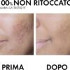 Vichy Normaderm Trattamento Anti-Imperfezioni a Doppia Azione per Pelli Grasse Effetto Correttivo e Idratante con Acido Salicilico, Acido Ialuronico e Frazioni Probiotiche, 50 ml