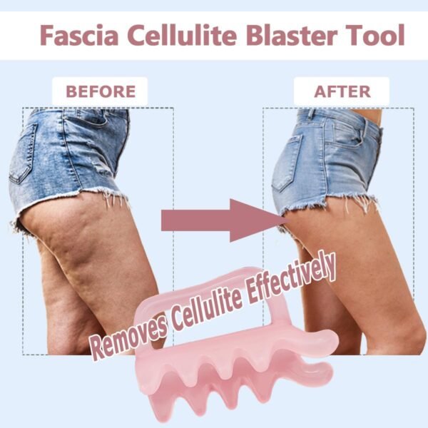 Strumento per il massaggio della cellulite, strumento di rilascio miofasciale per collo, spalle, schiena, massaggiatore per il corpo in resina - sollievo dalla tensione posteriore, sollievo dalla fascite