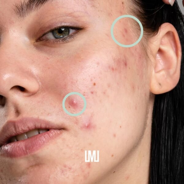 LAMUSELAB Sebonorm Integratore Capelli Donna con Estratti Vegetali Vitamine e Minerali, per il Benessere dei Capelli, Antiossidante per la Cura della Pelle, Senza Glutine, 90 Capsule