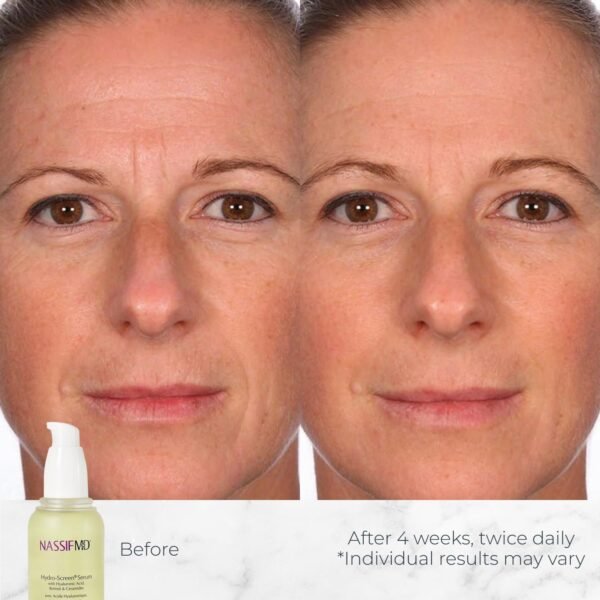 71ldeDGBVxL._AC_SL1500_.jpg Siero idratante NassifMD Hydro-Screen 30ml/10oz