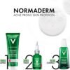 Vichy Normaderm siero detergente, peeling quotidiano per pelle con imperfezioni, macchie e cicatrici post-acne ridotte, struttura della pelle migliorata, acido glicolico e acido salicilico, 125 ml