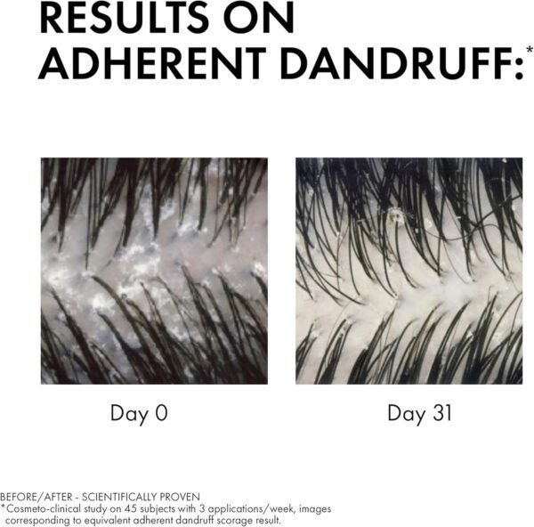 Vichy Dercos Sensitive Shampoo Antiforfora per Cuoio Capelluto Sensibile, Azione Lenitiva, Effetto Anti-Ricomparsa, Arricchito con Pirottolamina e AHA, 200 ml