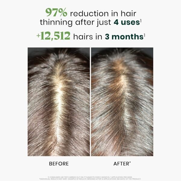 Trattamento Trifasico Anticaduta RF80 12 Fiale