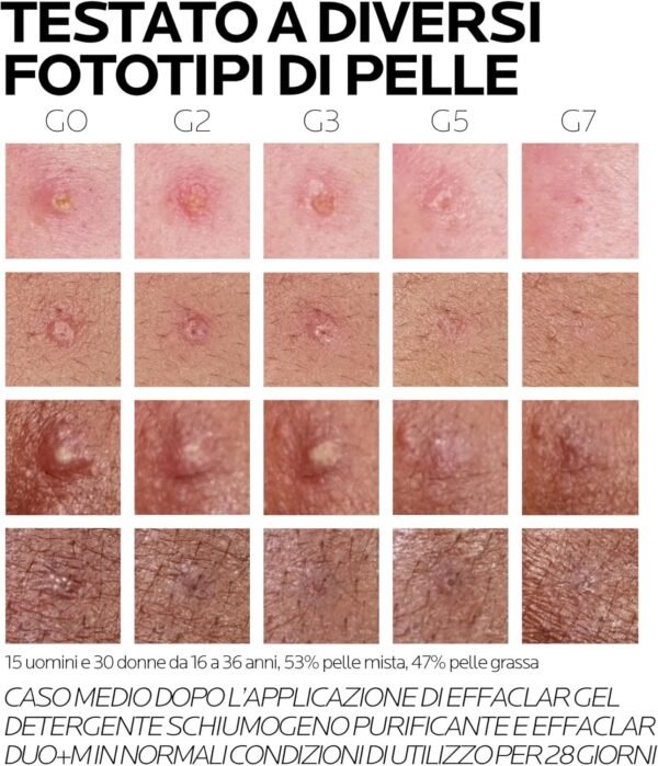 La Roche Posay Effaclar Duo + M, trattamento anti-imperfezioni tripla correzione per pelle grassa a tendenza acneica, effetto anti-ricomparsa, con filobioma, Procerad e niacinamide, 40 ml
