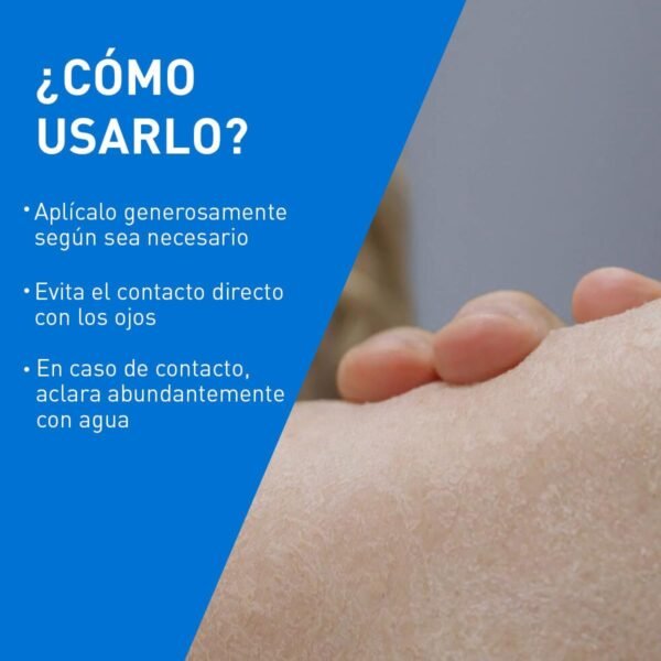 CeraVe lozione idratante intensiva per pelli molto secche, azione lenitiva, sollievo immediato dal prurito con 3 ceramidi essenziali, idrourea e burro di karitè, 8 oz