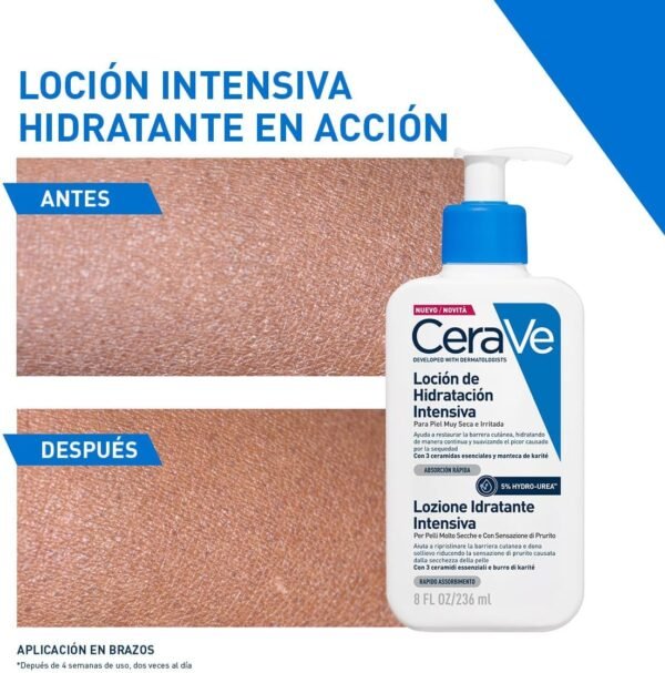 CeraVe lozione idratante intensiva per pelli molto secche, azione lenitiva, sollievo immediato dal prurito con 3 ceramidi essenziali, idrourea e burro di karitè, 8 oz