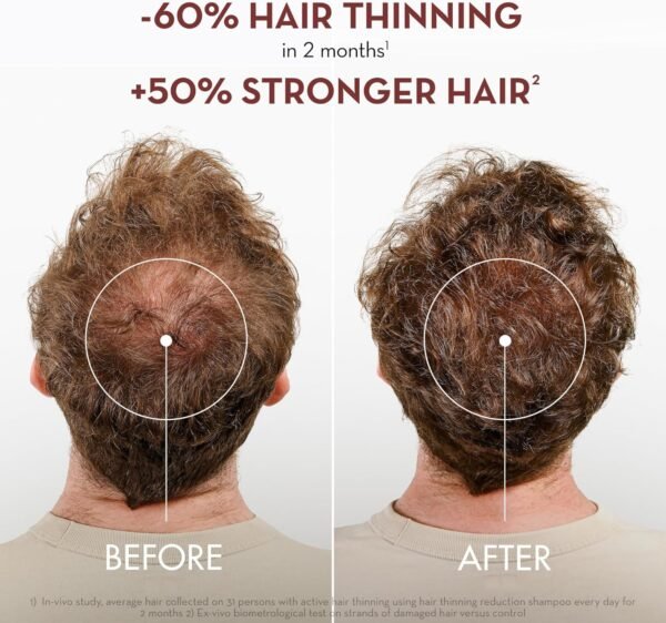 91aS1CpzawL._AC_SL1500_.jpg Shampoo Klorane Quinquina - 400 ml